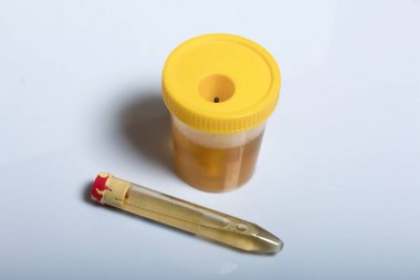 人對氧磷酶1(PON1)酶聯免疫elisa試劑盒 人對氧磷酶1(PON1)酶聯免疫elisa試劑盒